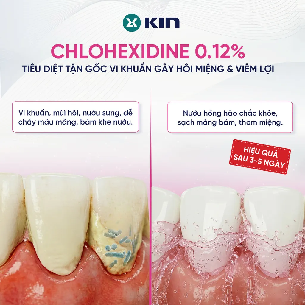 Ảnh 3